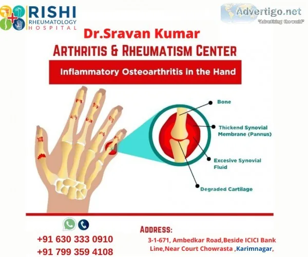 Dr sravan kumar appani | consultant rheumatologist karimnagar