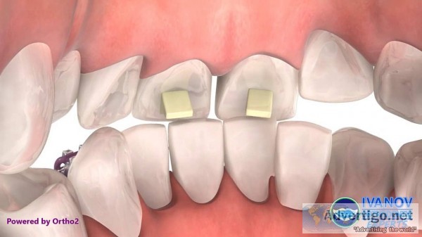 Best pediatric orthodontist near me