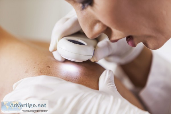 Online dermatologists doctor consultation in india