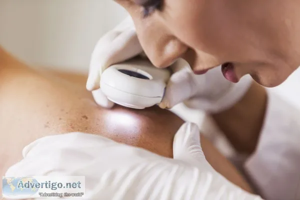 Online dermatologists doctor consultation in india