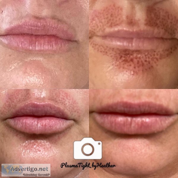 LipFlip PlasmaTight_byHeathe r