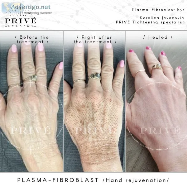 Certified Fibroblast skin PlasmaTight