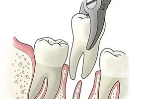 Orthodontic treatment cost