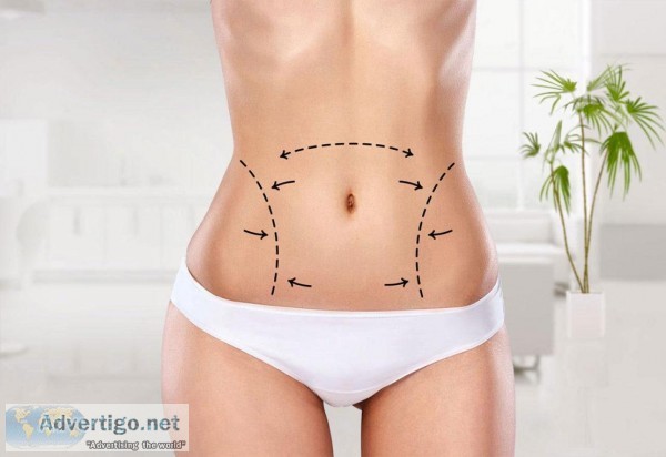 Liposuction