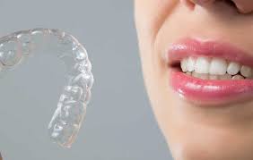 Pediatric dentistry in katy, tx