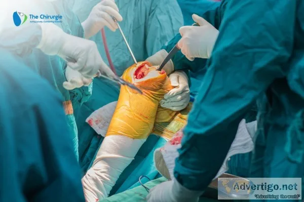 The chirurgie