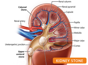 Best urologist in patna: dr kumar rajesh ranjan