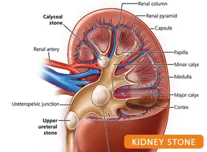 Best urologist in patna: dr kumar rajesh ranjan