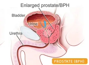 Best urologist in patna: dr kumar rajesh ranjan