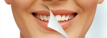 Best Porcelain Veneers in Hobart
