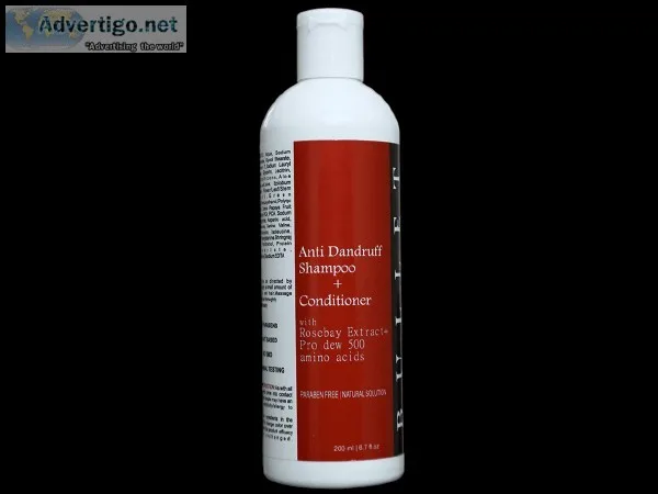 Get the rid for dry hair  and dandruff - Buy anti dandruff shamp