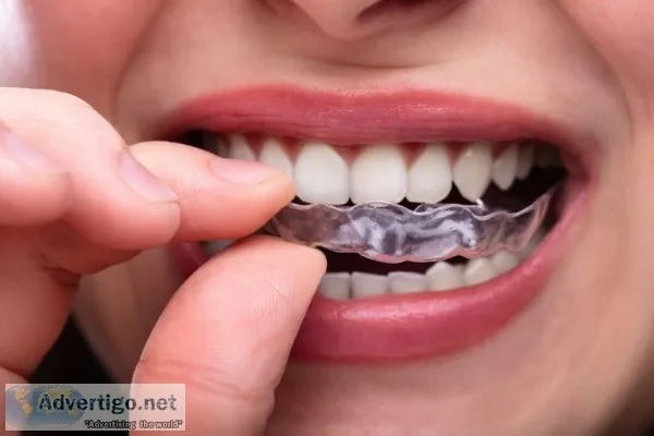 Dentures auckland