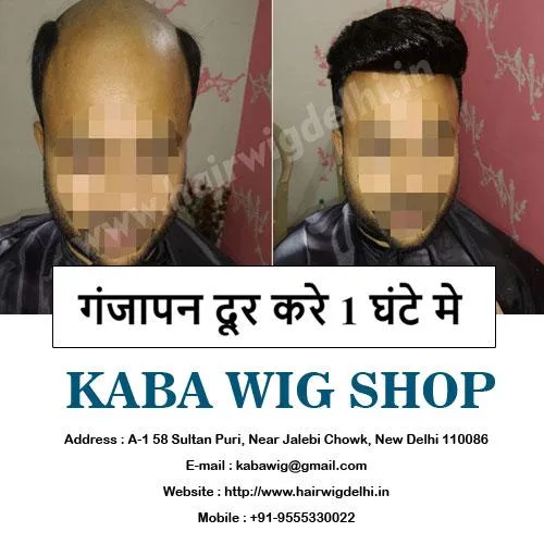 Best Hair Wigs Shop in Delhi