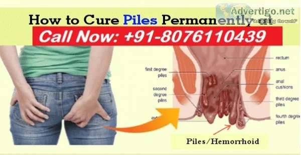 Piles specialist lady doctor in east of kailash - 8076110439