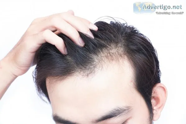 Hair Loss Treatment