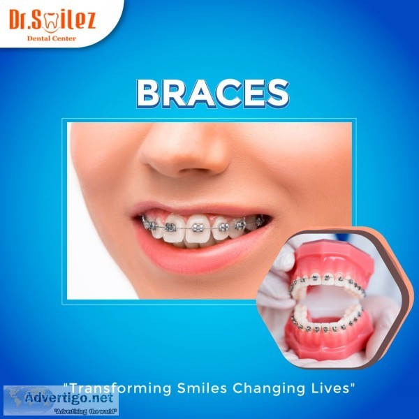Best dental clinic in chennai