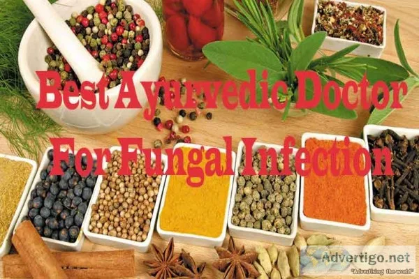 Best ayurvedic doctor for fungal infection