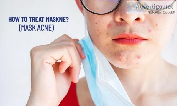 How to Treat face mask acne