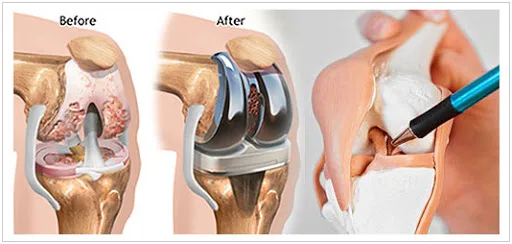 We have the best orthopedic doctor in jaipur