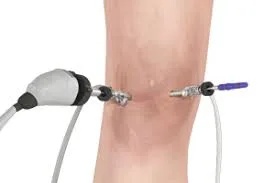 Arthroscopic surgeon in nallasopara