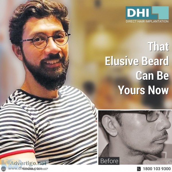 Beard transplant in chandigarh - dhi india