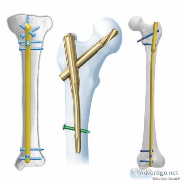 Supplier for orthopedic implants