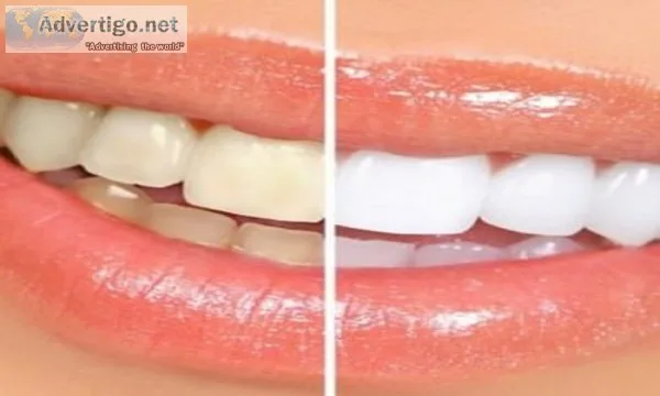 Best dentist in panchsheel park