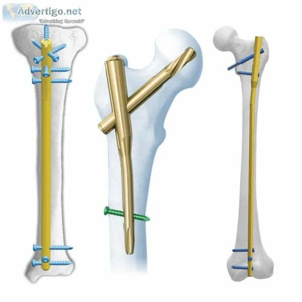 Orthopedic products manufacturers in india