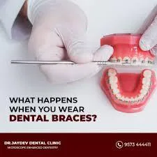 Best Teeth whitening treatments in RTC cross roads  Dr Jaydev