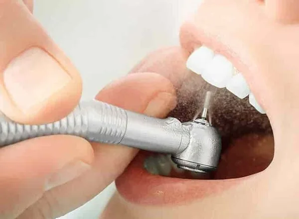 Best dental clinic in delhi with best dentist & dental treatment