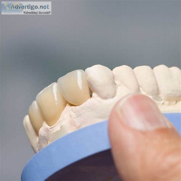 Teeth filling in coimbatore