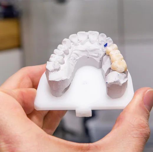 Dentures specialist in coimbatore