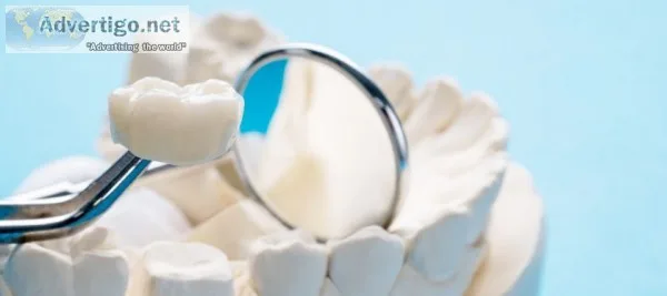 Dental implant in coimbatore