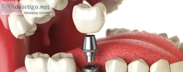 Best root canal clinic in coimbatore