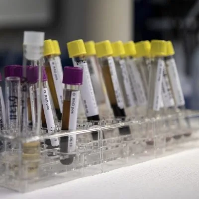 Health checkup, blood testing labs