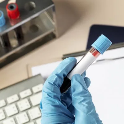 Health checkup, blood testing labs