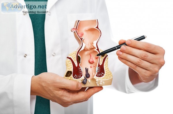 Laser treatment for fistula cost in coimbatore - fistula treatme