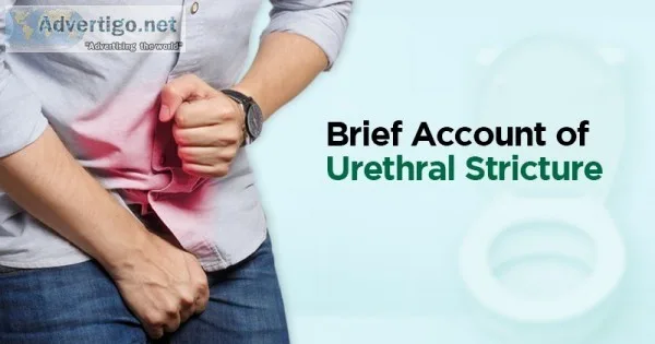 Urethral strictures in males treatment