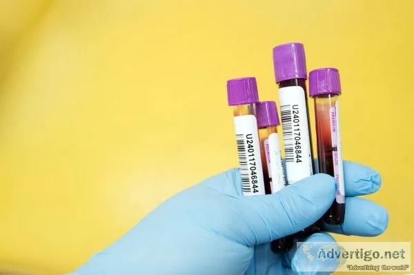 Get hba1c test done at home