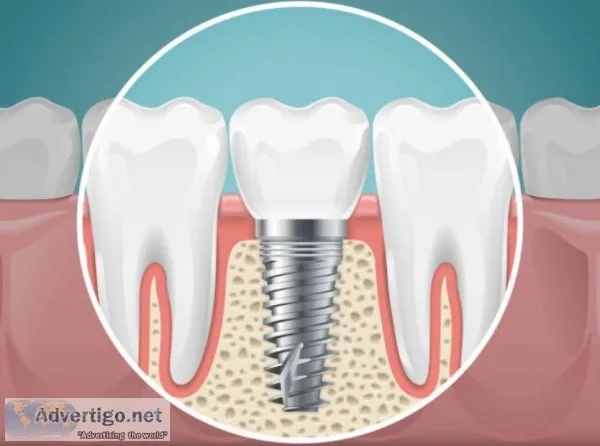 Dental clinic in naranpura