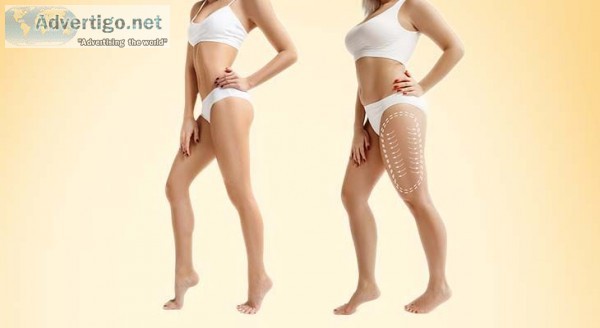 Fat removal surgery in dubai| liposuction cost in dubai