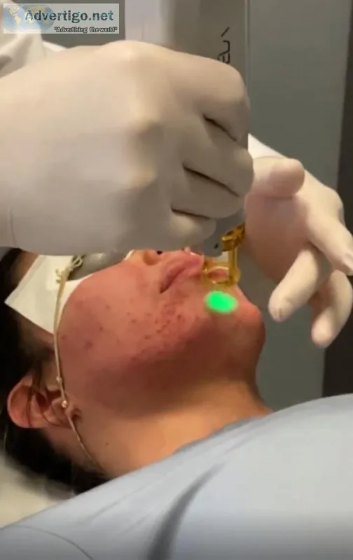 Aesthetic Laser