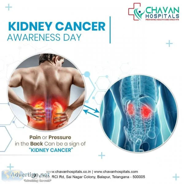 Best nephrologist in hyderabad