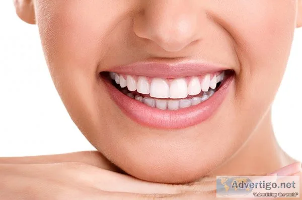 Best dental clinic abu dhabi
