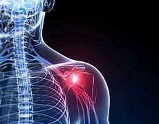 Frozen shoulder,Joint, Back Pain etc - Dr. Scott