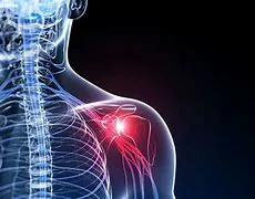 Frozen shoulder,Joint, Back Pain etc - Dr. Scott