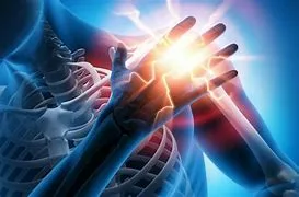 Frozen shoulder,Joint, Back Pain etc - Dr. Scott