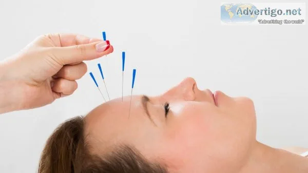 Get acupuncture treatment nearby your location