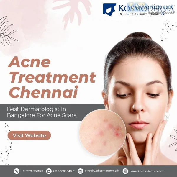 Best acne treatment in bangalore, chennai - pimple treatment