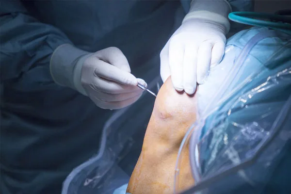 Arthroscopy surgery in jaipur